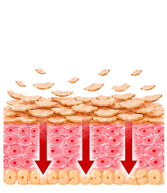Dead Skin Removal